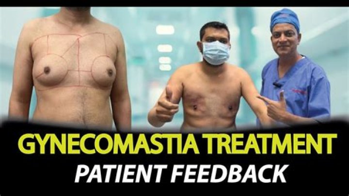 Can gynecomastia be cured without surgery?