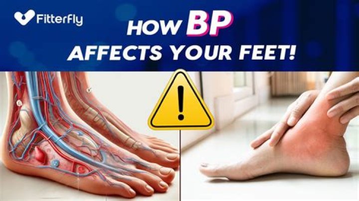 Can high blood pressure cause swollen feet?
