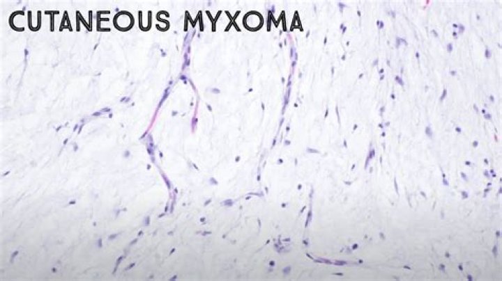 Can myxomatosis affect humans?