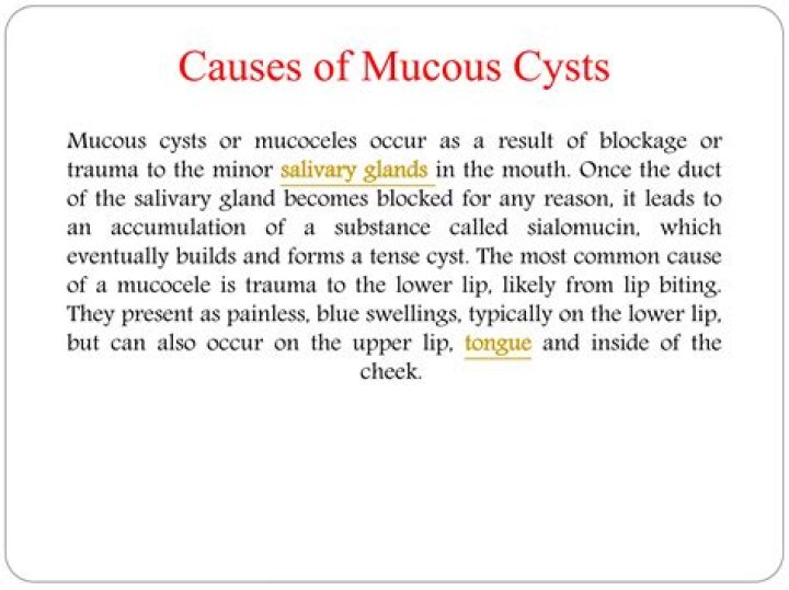 Can you pop a mucous cyst?