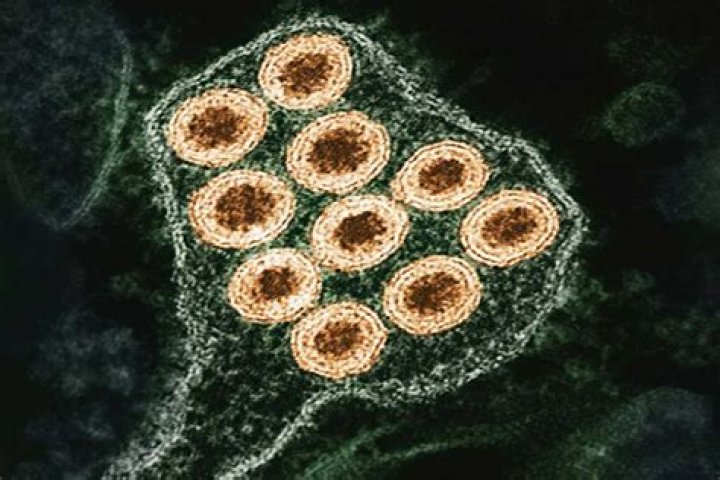 Could a rage virus happen?