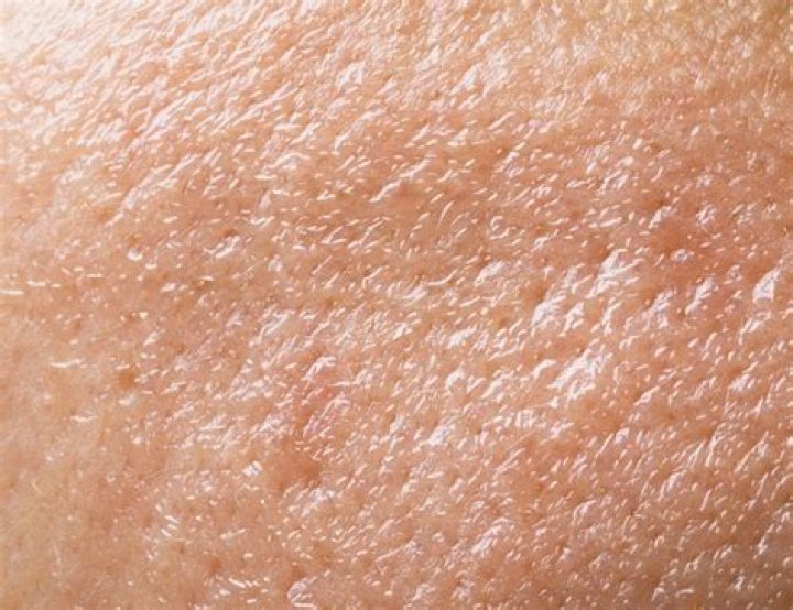 Do i have oily skin?
