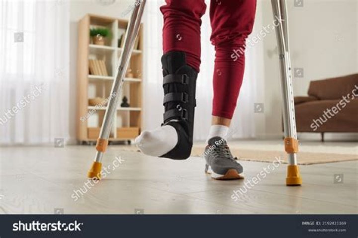 Do you need crutches for a dislocated knee?