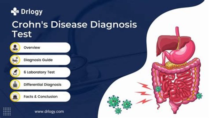 Does diagnosis help crohn's?
