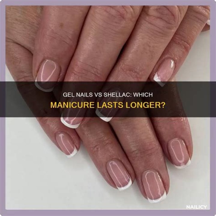 Does gel or shellac last longer?