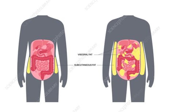 Does visceral fat burn first?