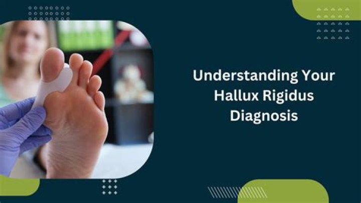How does hallux rigidus feel?