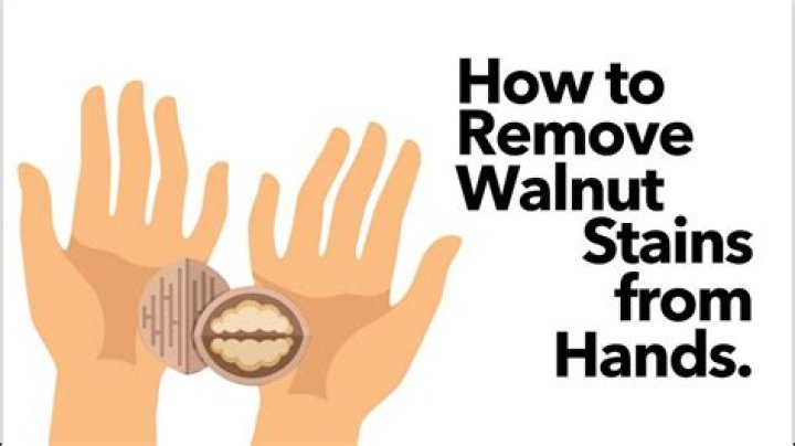 How to remove walnut stain from hands?