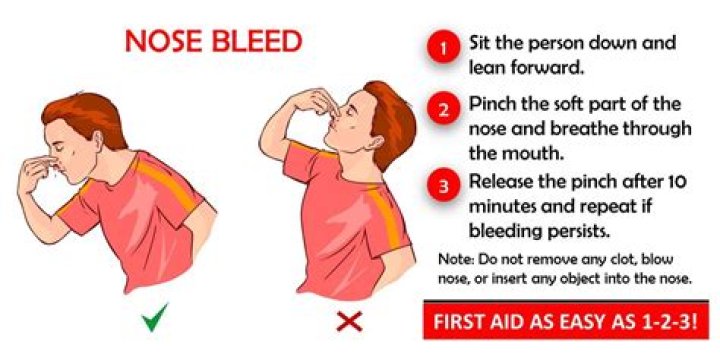 How to stop bloody nose?