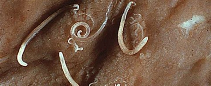 Is there a cure for whipworms?