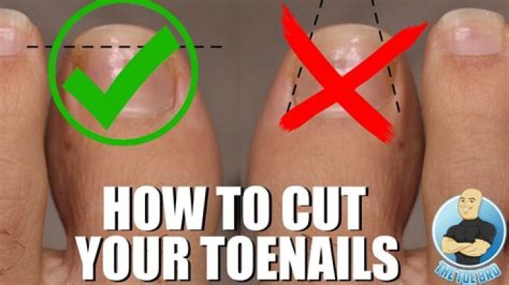 Should you cut toenails straight across?