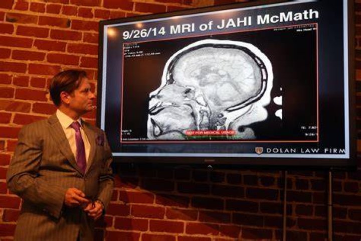 Was jahi mcmath brain dead?