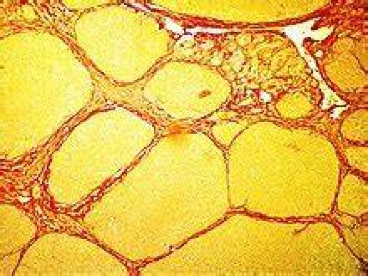 What does thioacetamide look like?