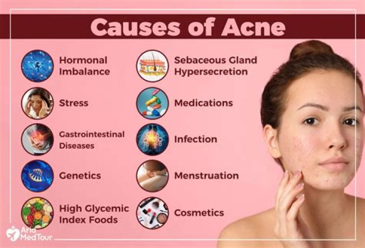 What gynecological problems cause acne?