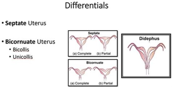 What is the difference between septate and bicornuate uterus?
