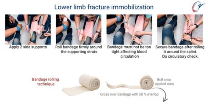 When immobilising limb fractures you should?