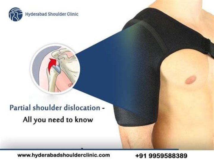 When to rehab a dislocated shoulder?