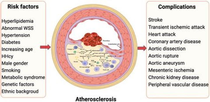 Which coronary artery is most susceptible to atherosclerosis?
