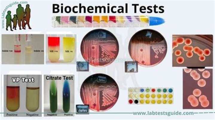 Why biochemical test is done?