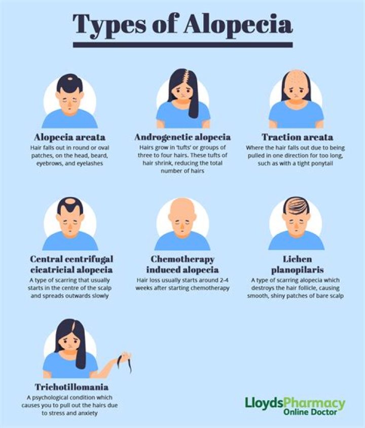 Why do you get alopecia?