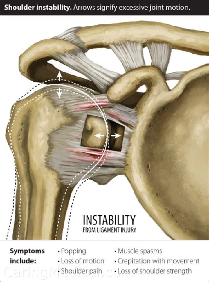 Why does a dislocated shoulder hurt?