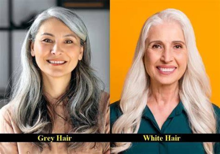 Why is some grey hair white?