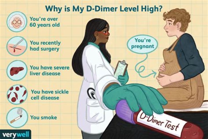 Why test for d dimer?